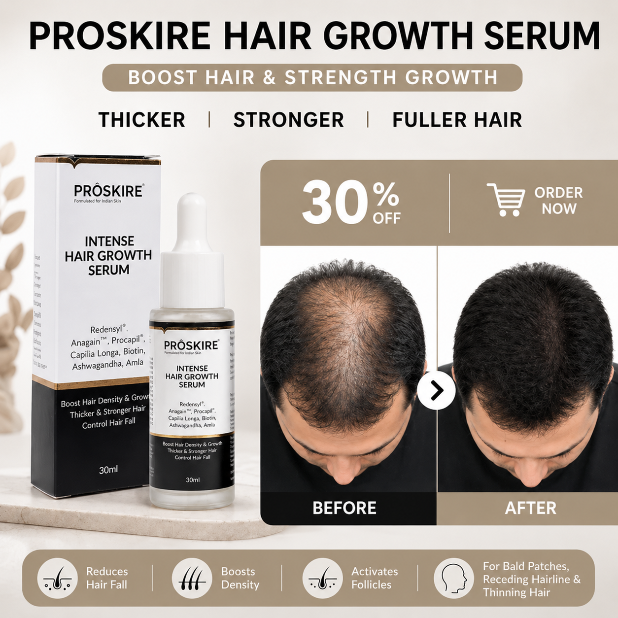 Proskire Intense Hair Growth Serum